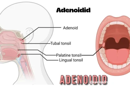 adenoidid